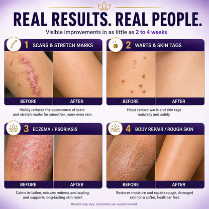 Limited-time offer: 70% off ⬇️Elivessa™ Biotin 10-in-1 Skin Restoration Cream