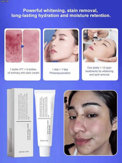 🏆Flash Sale⚡Hydrating and Nourishing Face Cream
