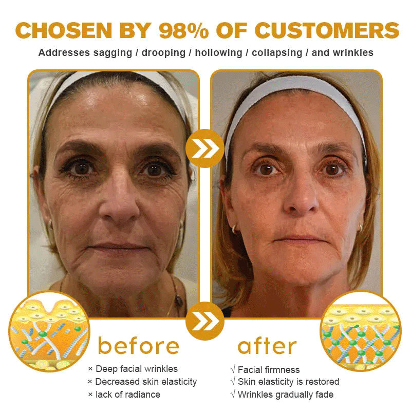 ✨Bee venom facial care ✨Smooth the Look of Wrinkles in 2 minutes — Fast, effective anti-ageing serum — save time and money