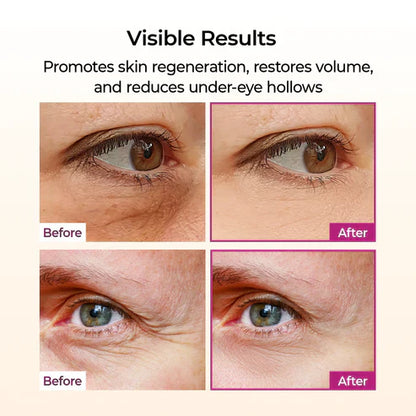 🏆 #1 Bestselling🏆--Cemenrete Calcium Multi Balm 💫 Anti-Aging & Firming Korean Skincare Stick🔥