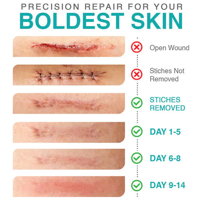 ✨ LAST DAY BUY 1 GET 1 FREE✨CareBreeze® 3-in-1 Microneedle Care Patch
