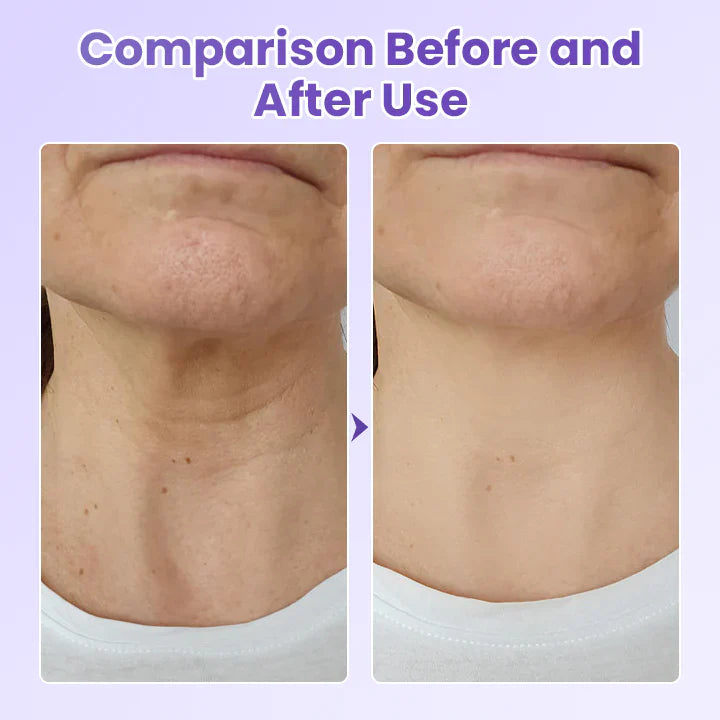 NeckYouth Peptide Anti-Wrinkle Patch